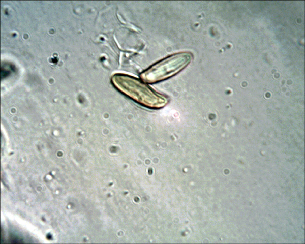 Xerocomus da determinare